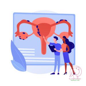 أسباب العقم عند النساء - بنات طب