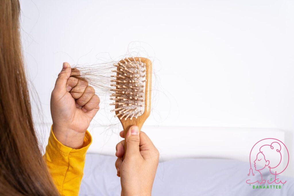 علاج تساقط الشعر الوراثي عند النساء - بنات طب